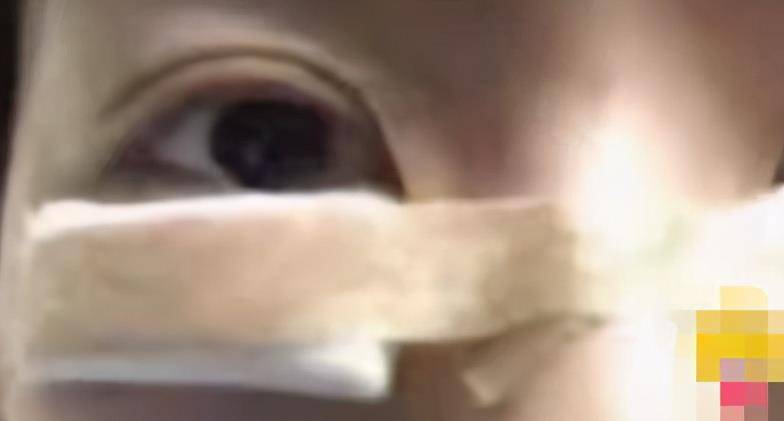 网红女的著名黑料,_孙一宁整容前照片_孙一宁整容前后对比